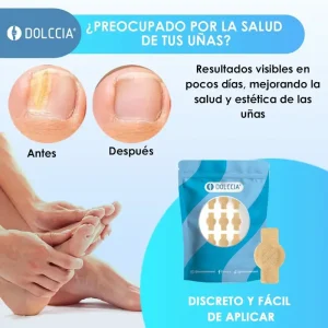PARCHES ANTIHONGOS DOLCCIA®