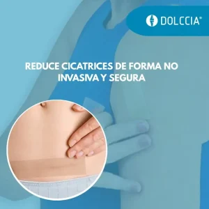 CINTA DE SILICONA PARA CICATRICES DOLCCIA®